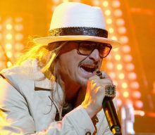 Kid Rock repeats homophobic slur while addressing recent video of him saying homophobic slur