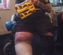 Former IRON MAIDEN Singer PAUL DI’ANNO To Undergo Long-Delayed Knee Surgery This Week