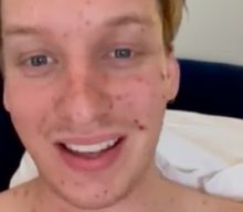 George Ezra reschedules upcoming UK shows after getting chicken pox